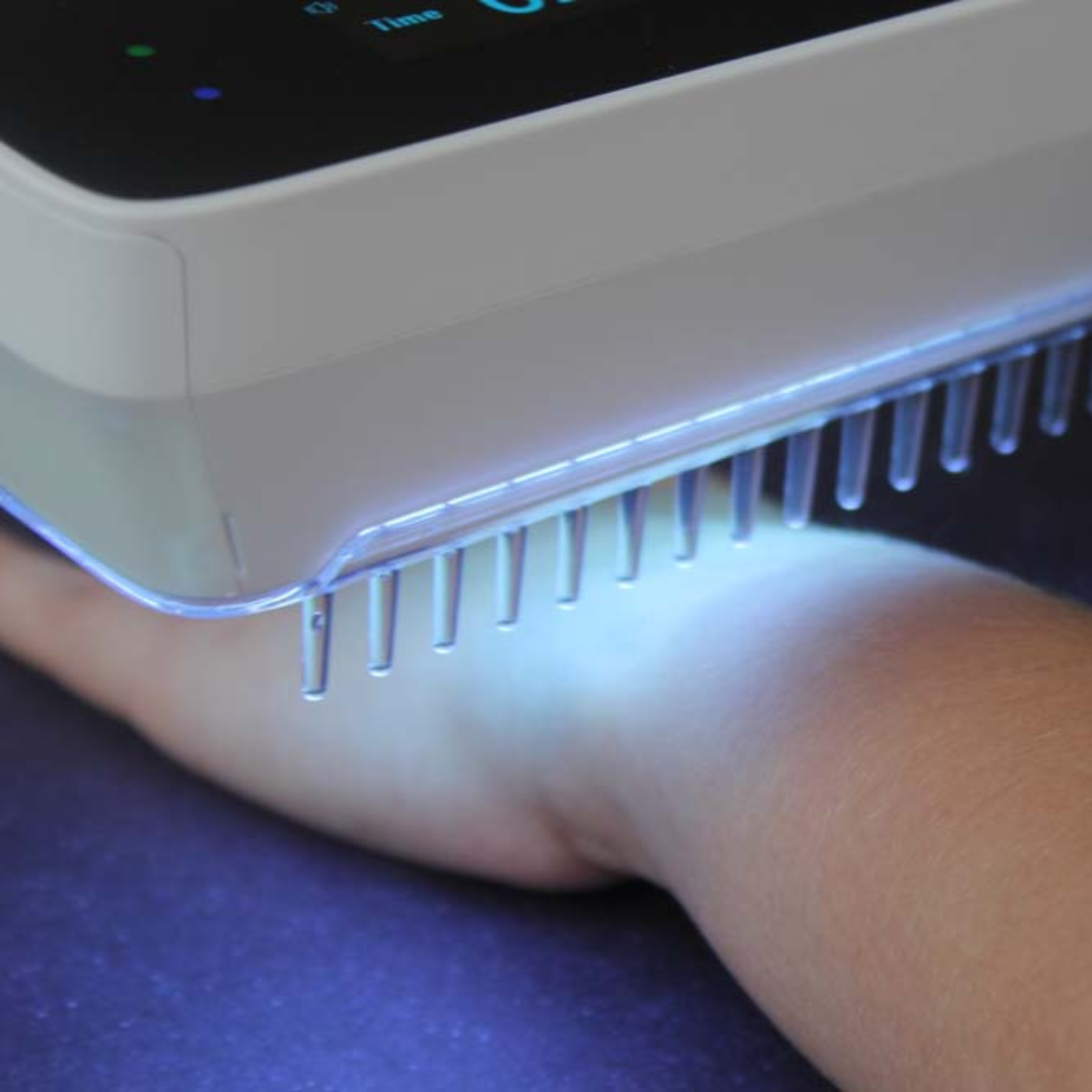 Handheld UVB Phototherapy Lamp – Psoriasis Vitiligo Narrow Band & Portable